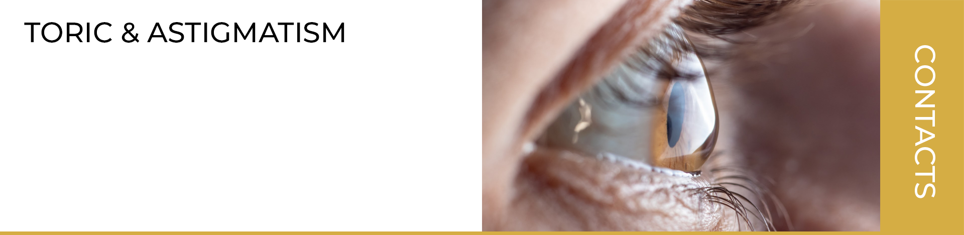 Toric/Astigmatism